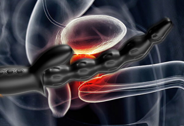 Pull beads in the back court